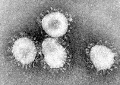 Korona-virus lähikuvassa, kuva: CDC/Dr. Fred Murphy