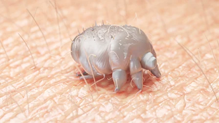Sarcoptes scabiei lähikuvassa