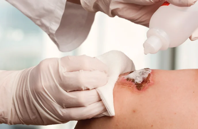 Hajunhallinta-herokuva